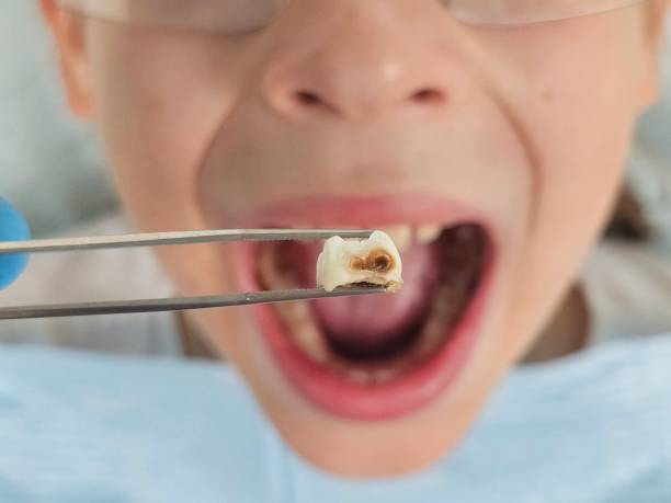 Best Cracked Tooth Emergency Dentist  in Hodgenville, KY